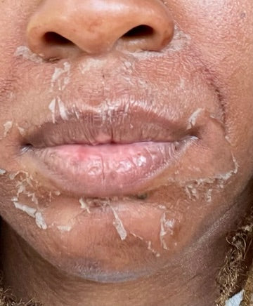 ✨🫧 Peel Kits 🫧✨ Curated by Prakash Organics 🌿🫧